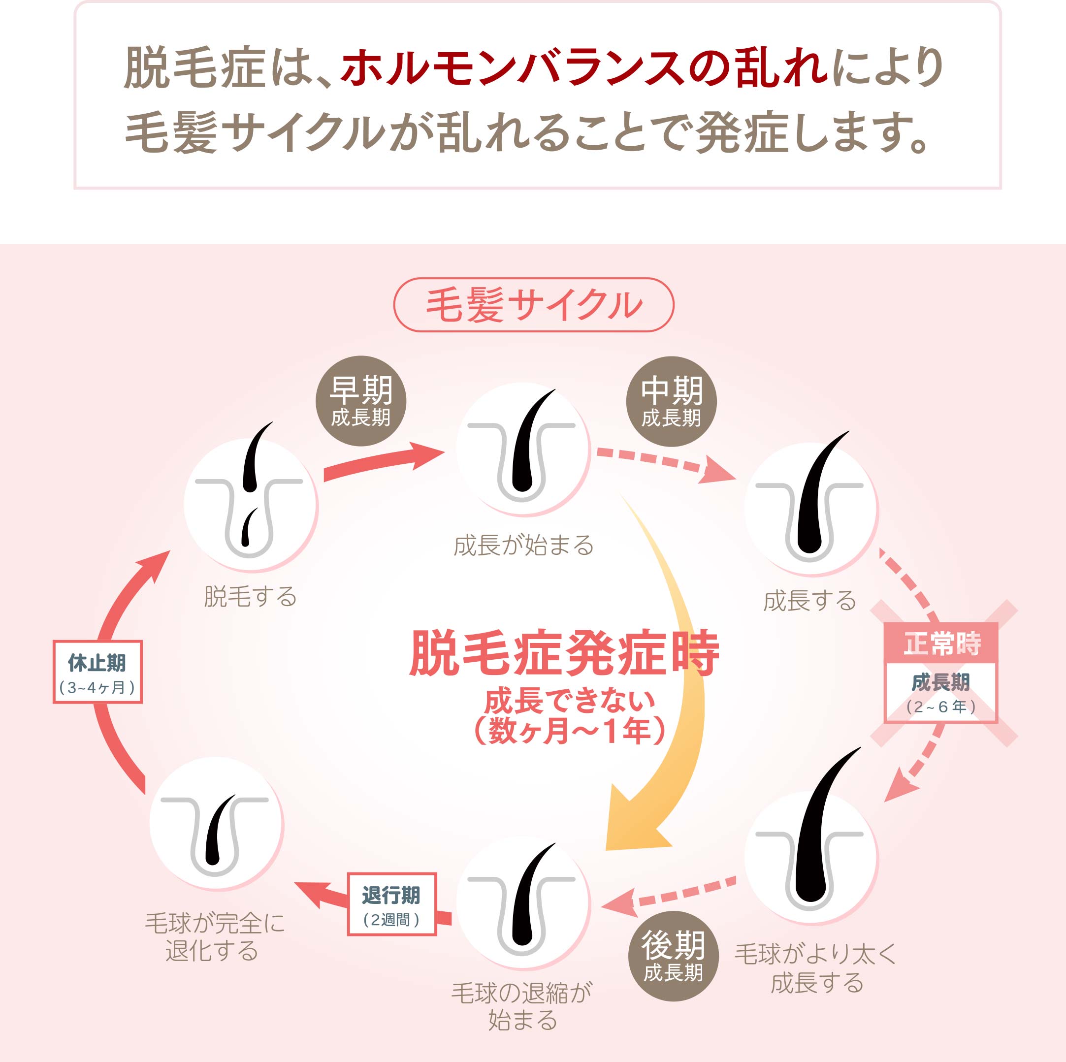 脱毛症は、ホルモンバランスの乱れにより毛髪サイクルが乱れることで発症します。